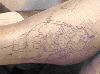 The transfer on the leg